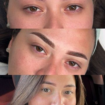 Resultado antes y después